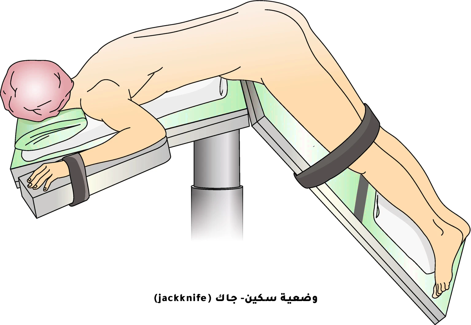 وضعية سكين جاك jackknife في عملية الشرخ الشرجي